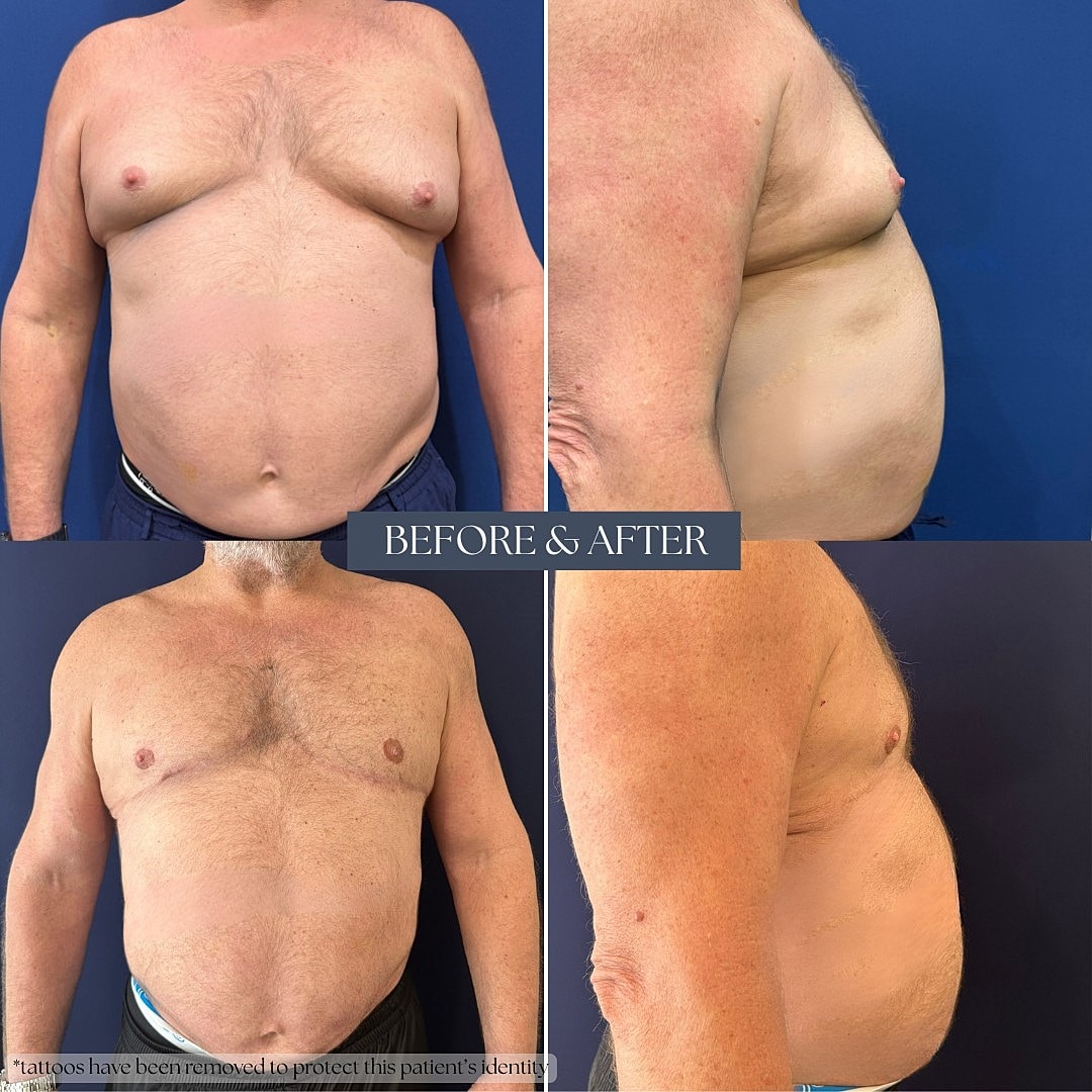 Before and after body transformation images