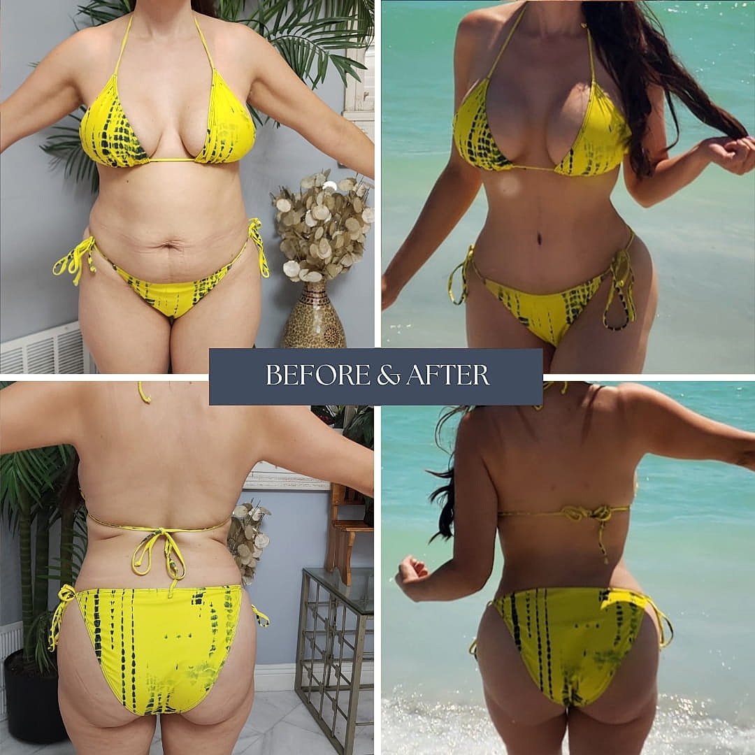 Before and after bikini transformation comparison.