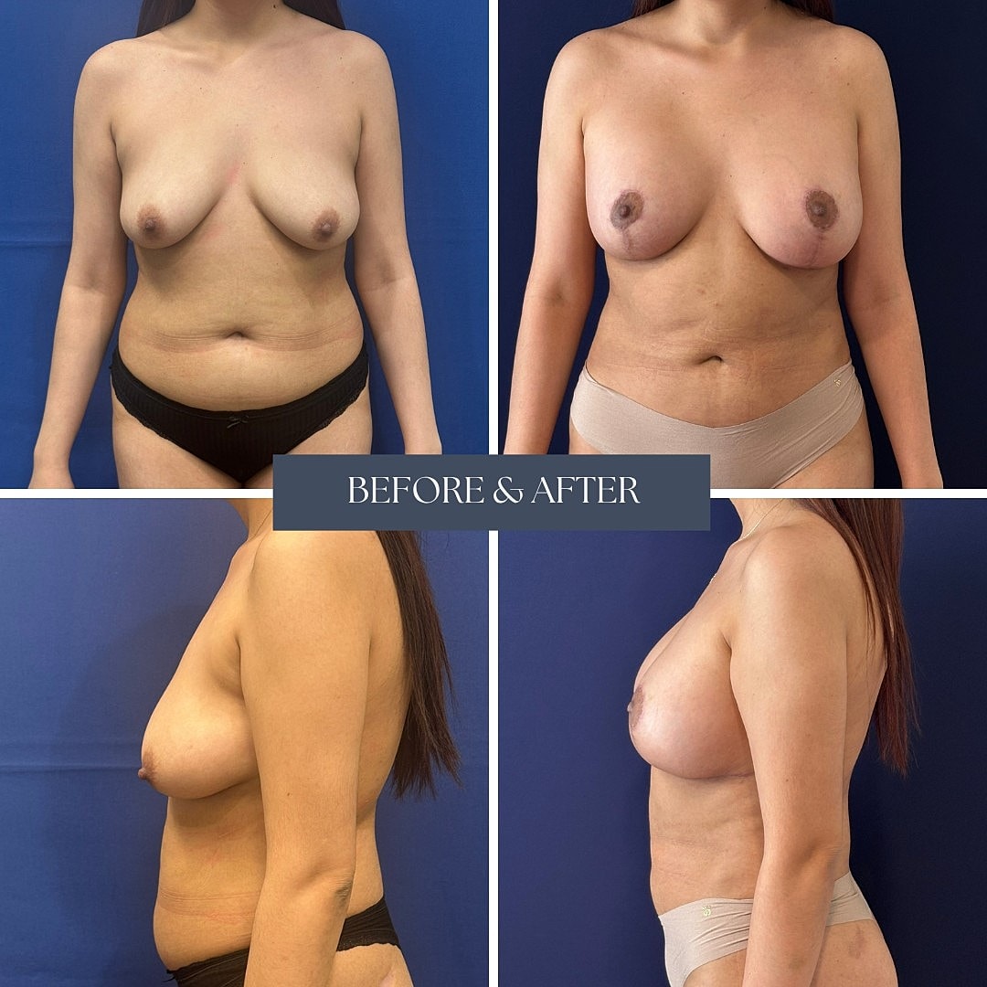 Before and after body transformation photos