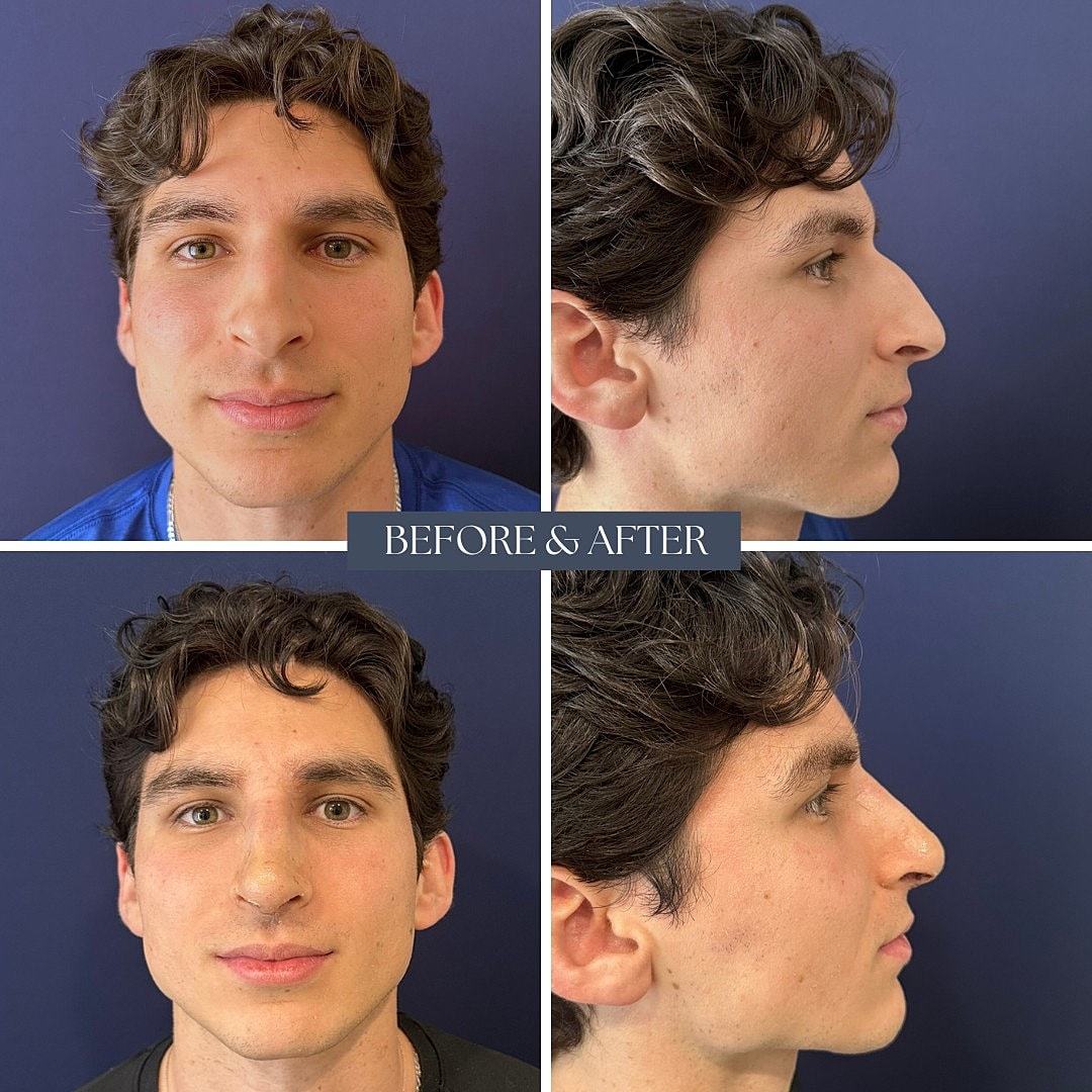 Before and after facial transformation photos.