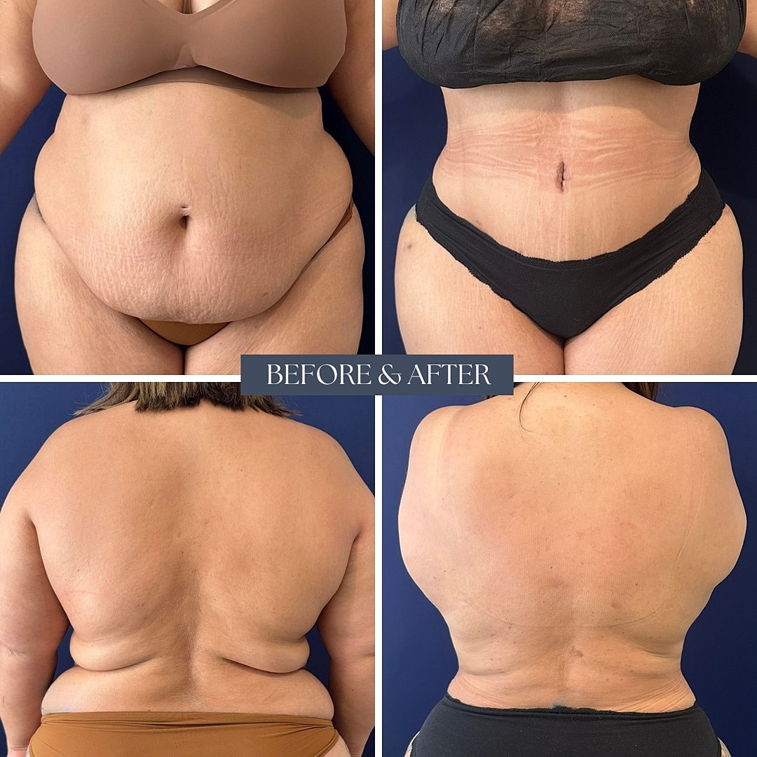 Body transformation before and after images.