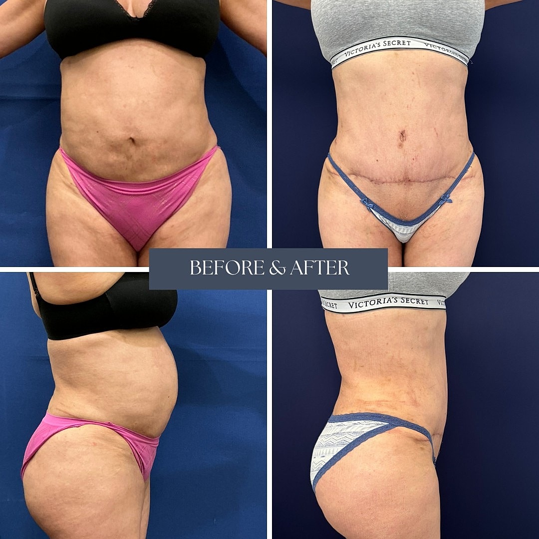 Body transformation before and after images.