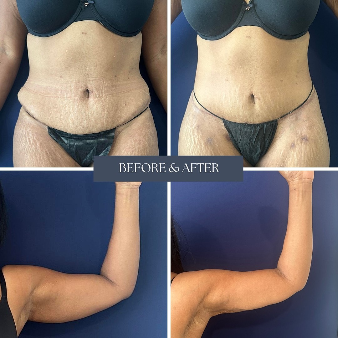 Body transformation before and after images.