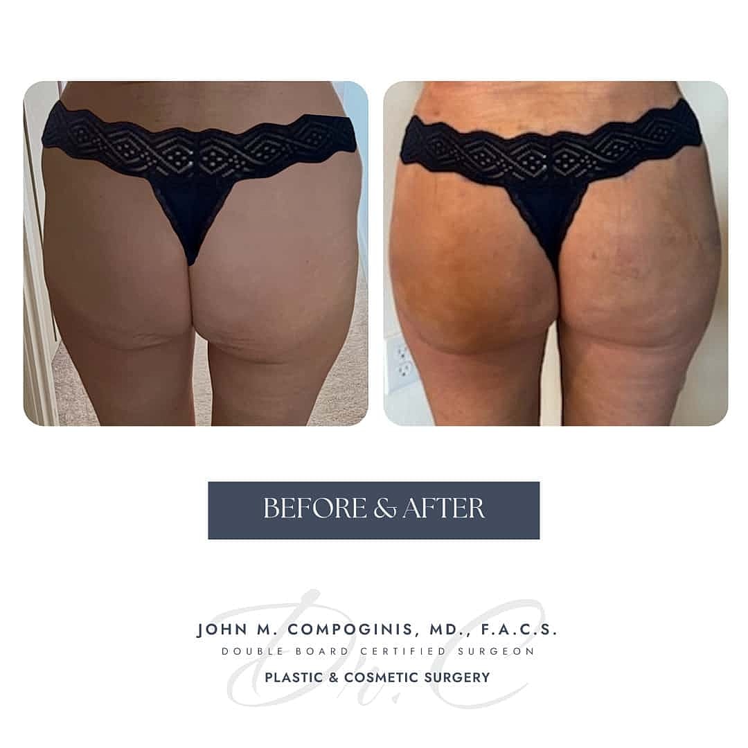 Before and after cosmetic surgery transformation image.